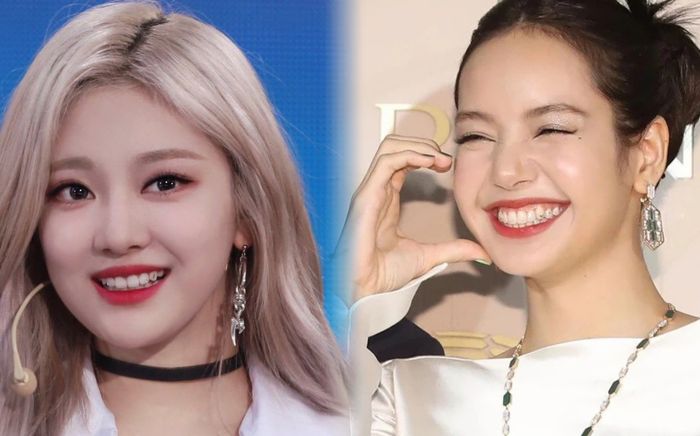 Netizen ồn ào tranh cãi khi sao Hàn rủ nhau 'tân trang' đá quý cho răng