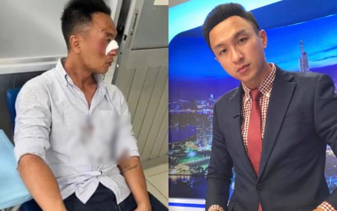 Nam MC nhập viện vì gặp tai nạn giao thông