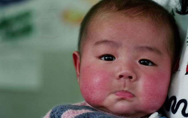 Miền Bắc vào đợt rét đậm, mẹ cần lưu ngay 5 bí quyết từ tự nhiên giúp bé không bị nứt nẻ, 'má đỏ cà chua'