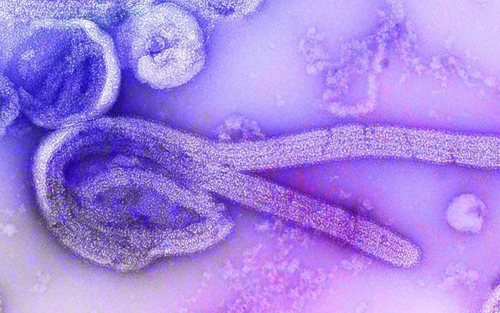 Bùng phát dịch bệnh nguy hiểm hơn cả COVID-19, tỷ lệ tử vong lên đến 88% nếu không có thuốc điều trị