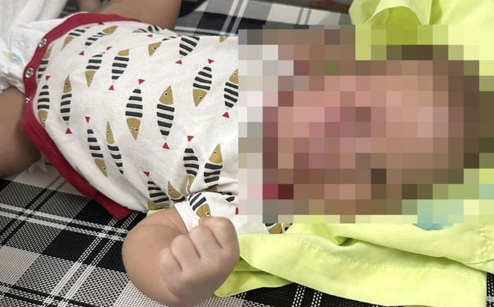 Vụ bé 3 tháng tuổi nhập viện nghi bị cha bạo hành: Công an vào cuộc