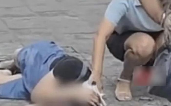 Cô gái thành người thực vật chỉ sau một đêm do món phụ kiện quen thuộc trên tóc