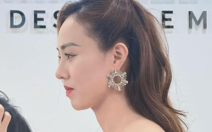 Vợ Công Lý khoe góc nghiêng hậu phẫu thuật thẩm mỹ