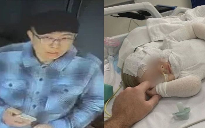 Bị người đàn ông lạ tạt cà phê nóng, bé trai 9 tháng tuổi bị bỏng nặng