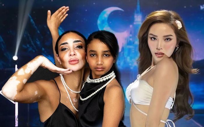 Người phụ nữ một con với làn da bạch biến sẽ đối đầu với Kỳ Duyên tại Miss Universe