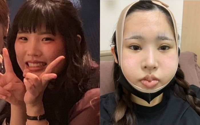 Nữ người mẫu chi 3,2 tỷ 'lột xác' sau khi bị tình cũ chê xấu và cái kết gây choáng