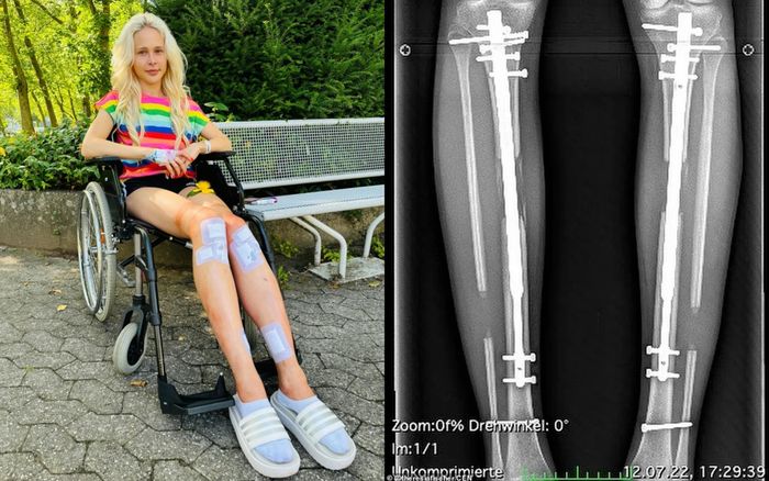 Chi 4 tỷ kéo chân chiều chồng, nữ người mẫu nhận cái kết đầy phũ phàng