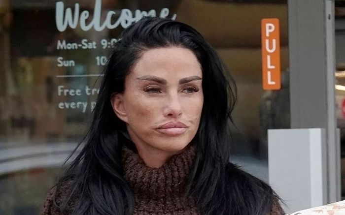 Nữ người mẫu chi 330 triệu bơm căng da mặt, kết quả hiện tại gây bất ngờ