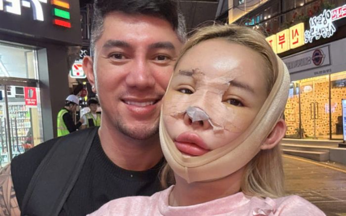 Diện mạo Ngân 98 sau 3 tháng phẫu thuật thẩm mỹ