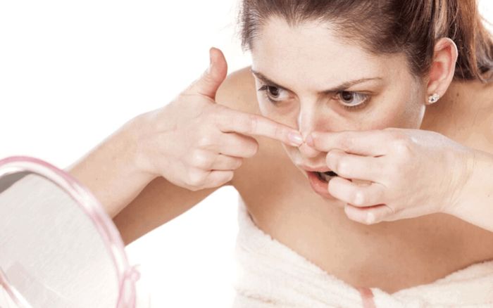 Những điều cần lưu ý khi bạn 'ngứa tay' muốn nặn mụn tại nhà