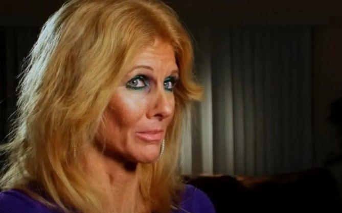 Người phụ nữ 49 tuổi mắc chứng 'nghiện trang điểm' khiến người xung quanh lo lắng