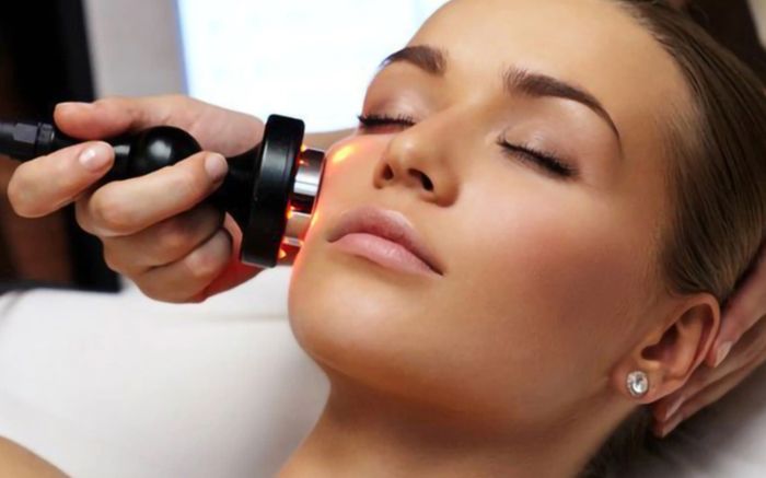 Những điều cần biết về phương pháp vi kim da mặt