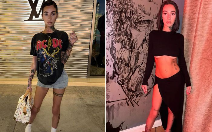 Nữ ca sĩ bị chỉ trích vì ngoại hình gầy trơ xương, tiết lộ tình trạng khiến nhiều người xót xa