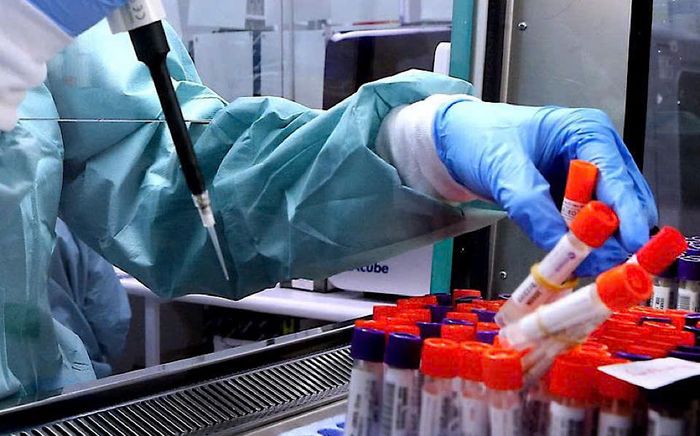 Australia làm thất lạc 300 lọ virus nguy hiểm chết người