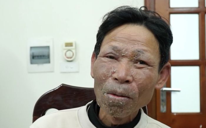 Video: Lời khai với tình tiết bất ngờ của kẻ đốt quán hát khiến 11 người tử vong