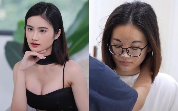 Quá trình bí mật thay đổi gương mặt của Hoa hậu Ý Nhi