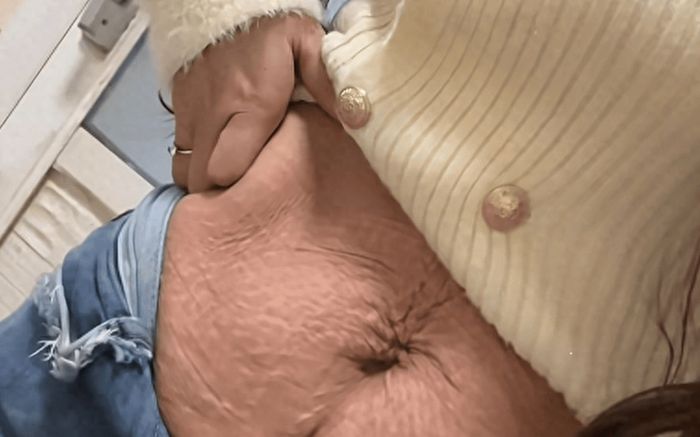 Mẹ trẻ 26 tuổi gây sốt với bụng bầu sau sinh như bà cụ 80 tuổi