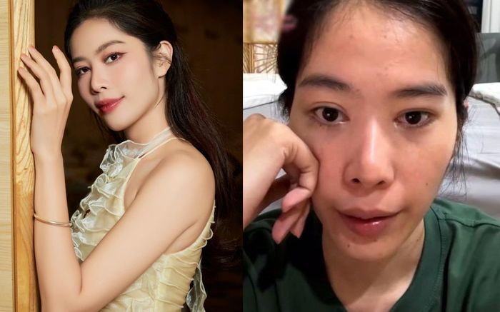 Nhan sắc ngày càng xuống cấp của Nam Em