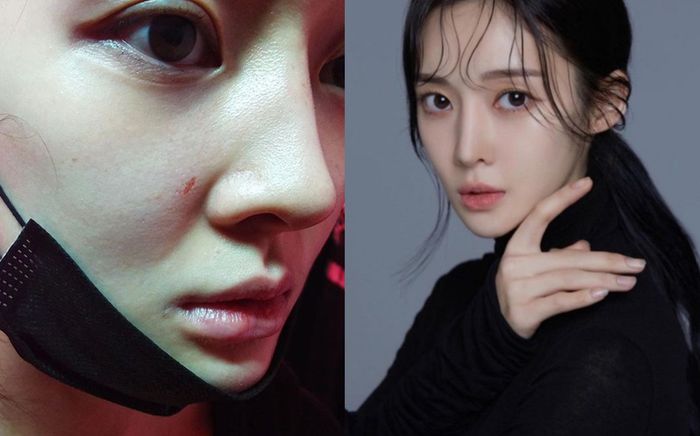 Nữ ca sĩ nổi tiếng bất ngờ tung ảnh bị chồng cũ bạo hành, phải trốn về nhà bố mẹ đẻ