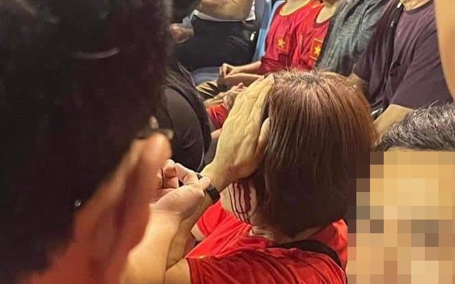 Công an vào cuộc nữ CĐV trận Việt Nam - Indonesia bị đánh trên sân Mỹ Đình