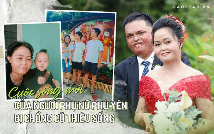 Cuộc sống mới của phụ nữ bị chồng cũ thiêu sống, cơ thể chằng chịt sẹo 92%