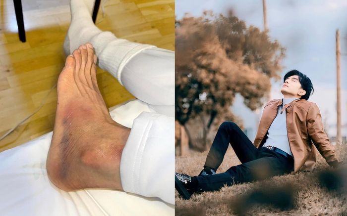 Đan Trường bước hụt chân té cái ầm, không đứng dậy được, đau thấu trời
