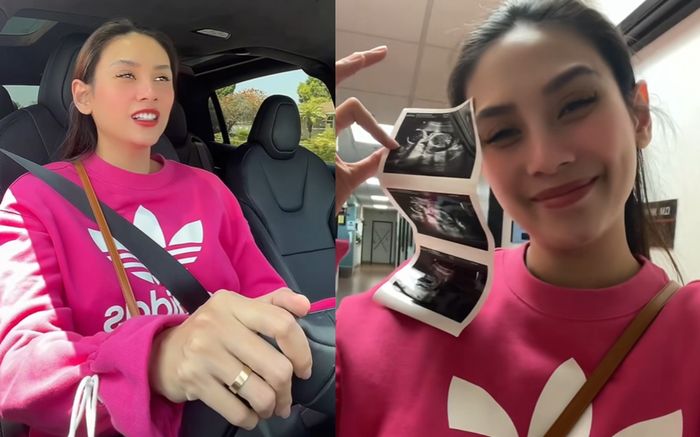 Võ Hoàng Yến đơn độc đi khám thai, tiết lộ lý do không có chồng theo cùng