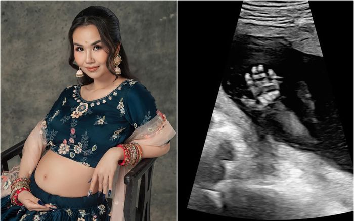 Võ Hạ Trâm khoe ảnh siêu âm con thứ 2, để lộ chi tiết khiến dân tình đoán là 'hoàng tử bé'