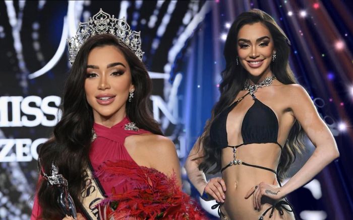 Body đẹp như tạc tượng của tân Hoa hậu Hòa bình CH Séc 2024