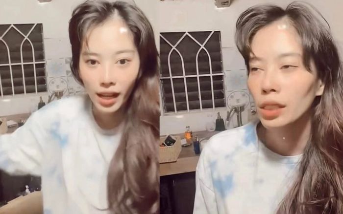 Nam Em kể chuyện thẩm mỹ hỏng, giờ hối hận không kịp