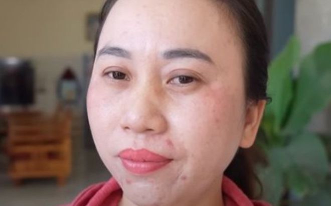 Người phụ nữ Quảng Ngãi 'độc lạ': Hơn 11 năm không ngủ nhưng tinh thần vẫn vui vẻ