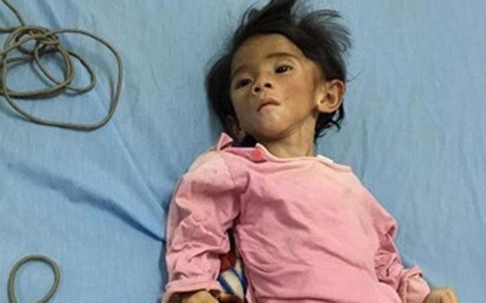 Bé gái chỉ có 'da bọc xương', trông như cụ già được cô gái trẻ nhận nuôi giờ ra sao?