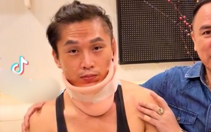 Tình hình sức khoẻ của nam ca sĩ bị thương nặng, mặt bầm tím phải cấp cứu hiện ra sao?