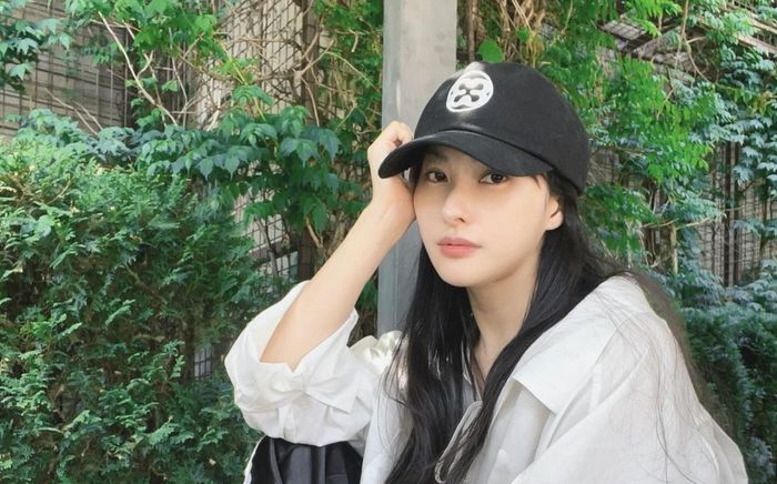 Nữ ca sĩ xinh đẹp bị gãy xương nghiêm trọng ở xương gò má và hốc mắt, tình trạng gây lo lắng