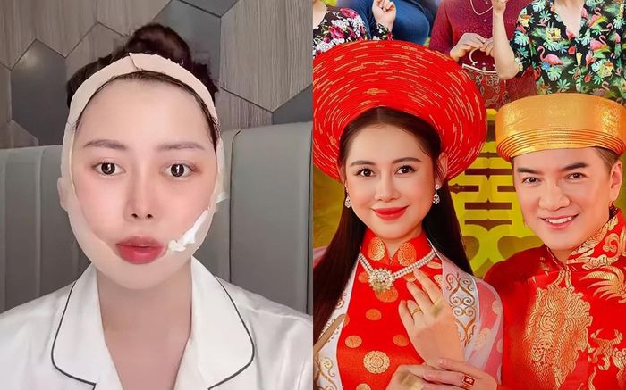 Nhan sắc gây chú ý của 'bà xã' vừa được Đàm Vĩnh Hưng công khai, từng bị biến chứng do tiêm silicon