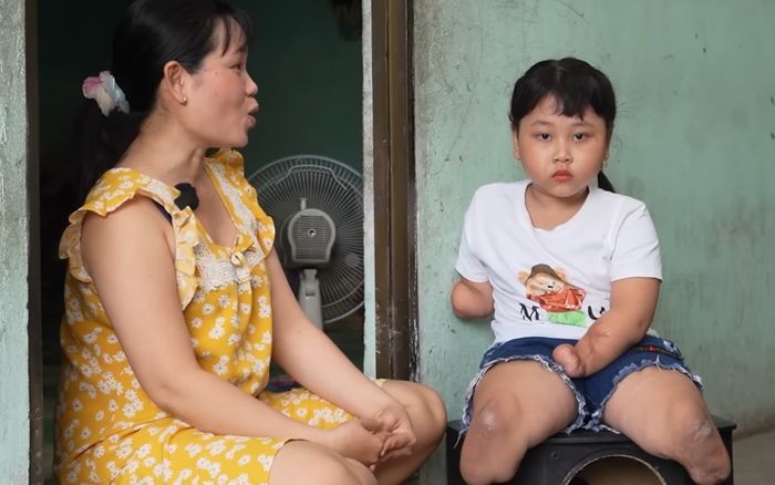 Sau cơn sốt, bé gái bỗng không có tay chân và nghị lực phi thường