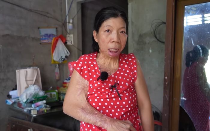 Người phụ nữ Vĩnh Long suốt 20 năm không có nụ cười, nghe lý do thật xót xa