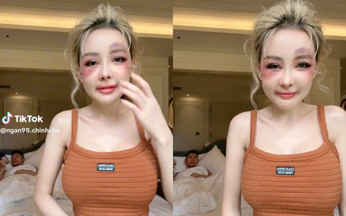 Ngân 98 mặt mày bầm tím, bị Lương Bằng Quang chọi đồ vào người
