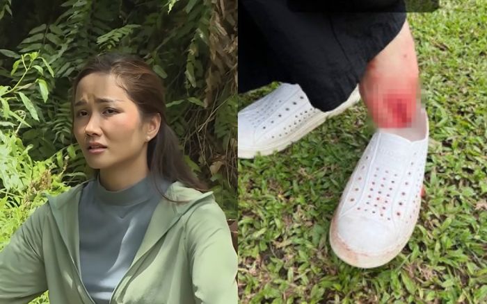 H'Hen Niê đăng ảnh chi chít vết thương sau một chuyến trồng rừng