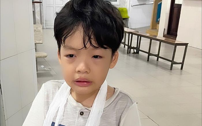 Con trai Dương Cẩm Lynh gặp sự cố gãy tay