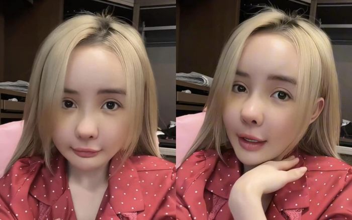 Ngân 98 trông như trẻ con sau lần 'đập mặt xây lại'