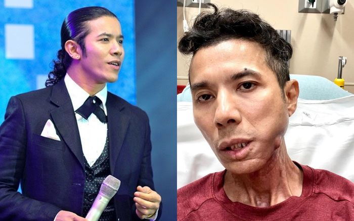 Ca sĩ Kasim Hoàng Vũ không còn khả năng để tiếp tục hát