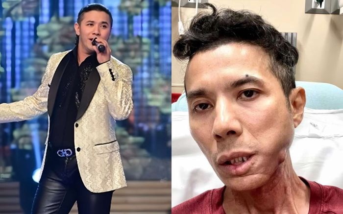 'Ca sĩ Kasim Hoàng Vũ bệnh nặng hơn những gì chúng ta biết'