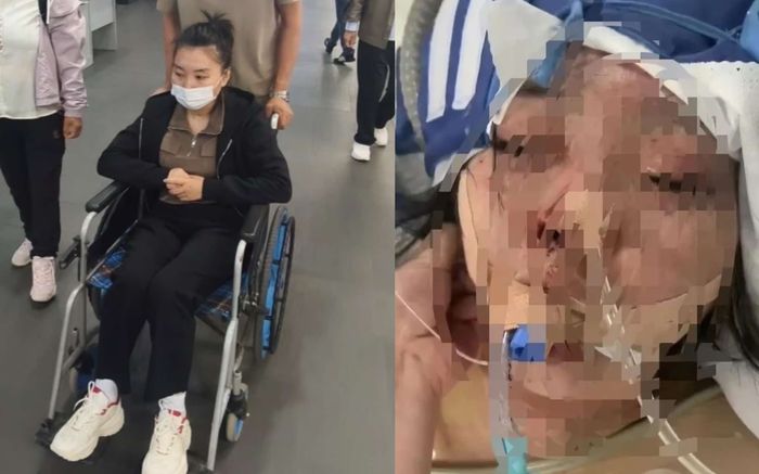 Con trai nghe lời mẹ, đánh vợ đến mù mắt vì không cho tiền nạp game