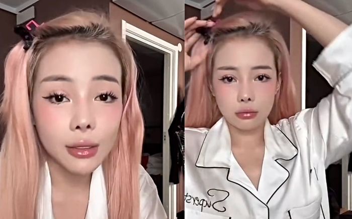 Choáng với số tiền mà Ngân 98 công khai để sửa mũi