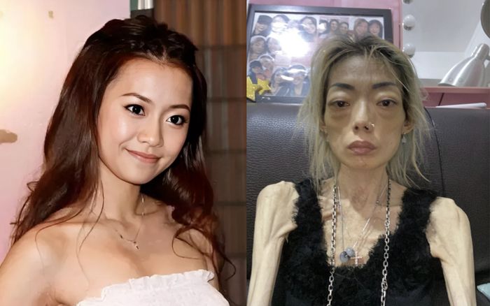 Nữ người mẫu hủy hoại dung nhan, chỉ còn da bọc xương vì lời chê bai của chồng tỷ phú