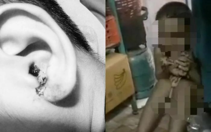 Cô giáo tát bé trai 6 tuổi chảy máu tai vì không trả lời được câu hỏi trên lớp