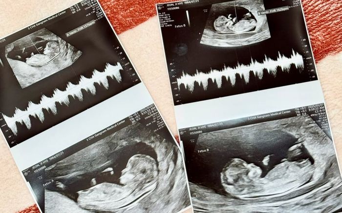 Nữ ca sĩ thông báo mang song thai, nhiều đồng nghiệp chúc mừng