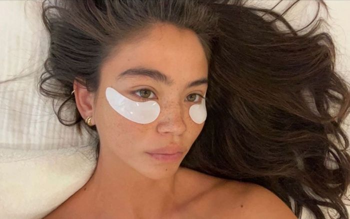 Lời khuyên từ chuyên gia da liễu để đánh bay bọng mắt