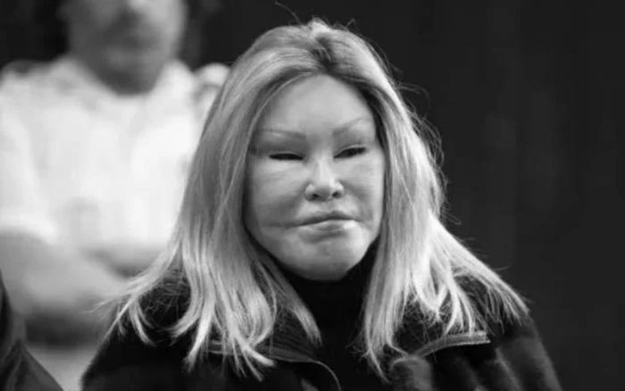 Nữ tỷ phú nghiện phẫu thuật thành mèo đột ngột qua đời